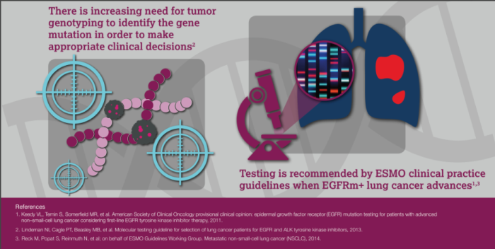 lung cancer