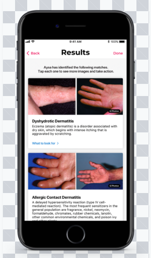 Aysa-Amazing App to help you figure out Skin Conditions!!